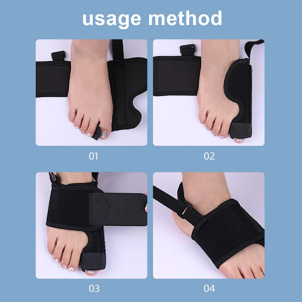 Correcteur Hallux Valgus Pro — Attelle Réglable avec Renfort Aluminium