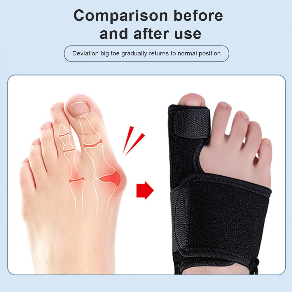 Correcteur Hallux Valgus Pro — Attelle Réglable avec Renfort Aluminium
